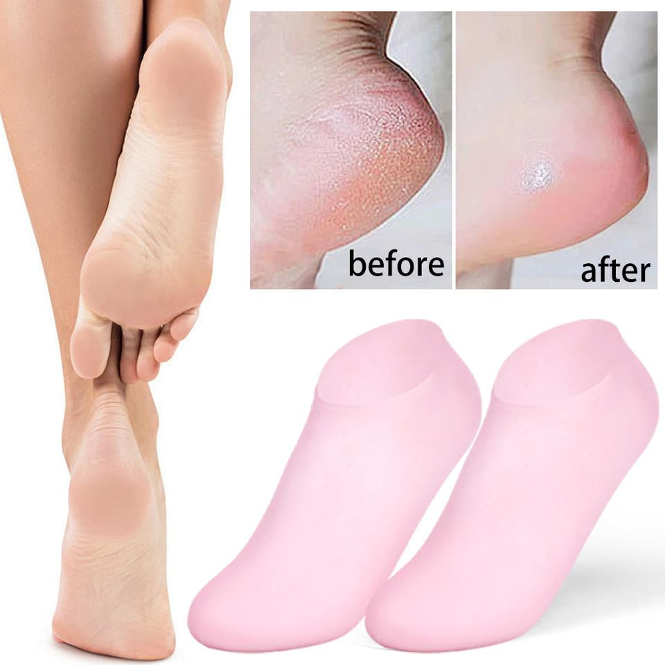 Silicone Gel Heel Pad Socks For Pain Relief And Anti Crack Heel 1 Pair Heel Cups Heel Guards Heel Protectors Heel Sleeves For Relieve Heel Pads Cushion Heel Pain, Heal Dry Cracked Heels, Achilles Tendinitis, For Men & Women