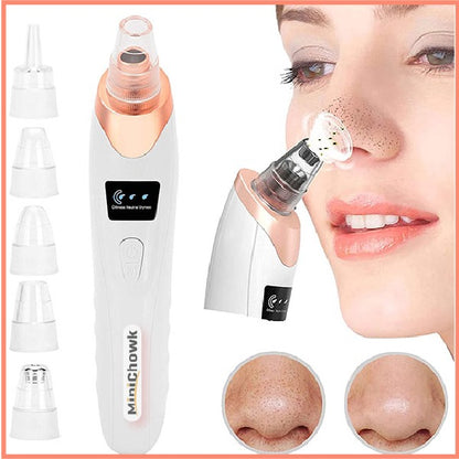 5 in 1 Blackhead Remover Vacuum – Electric Pore Cleaner with 5 Suction Heads, USB Rechargeable Facial Skin Care Tool