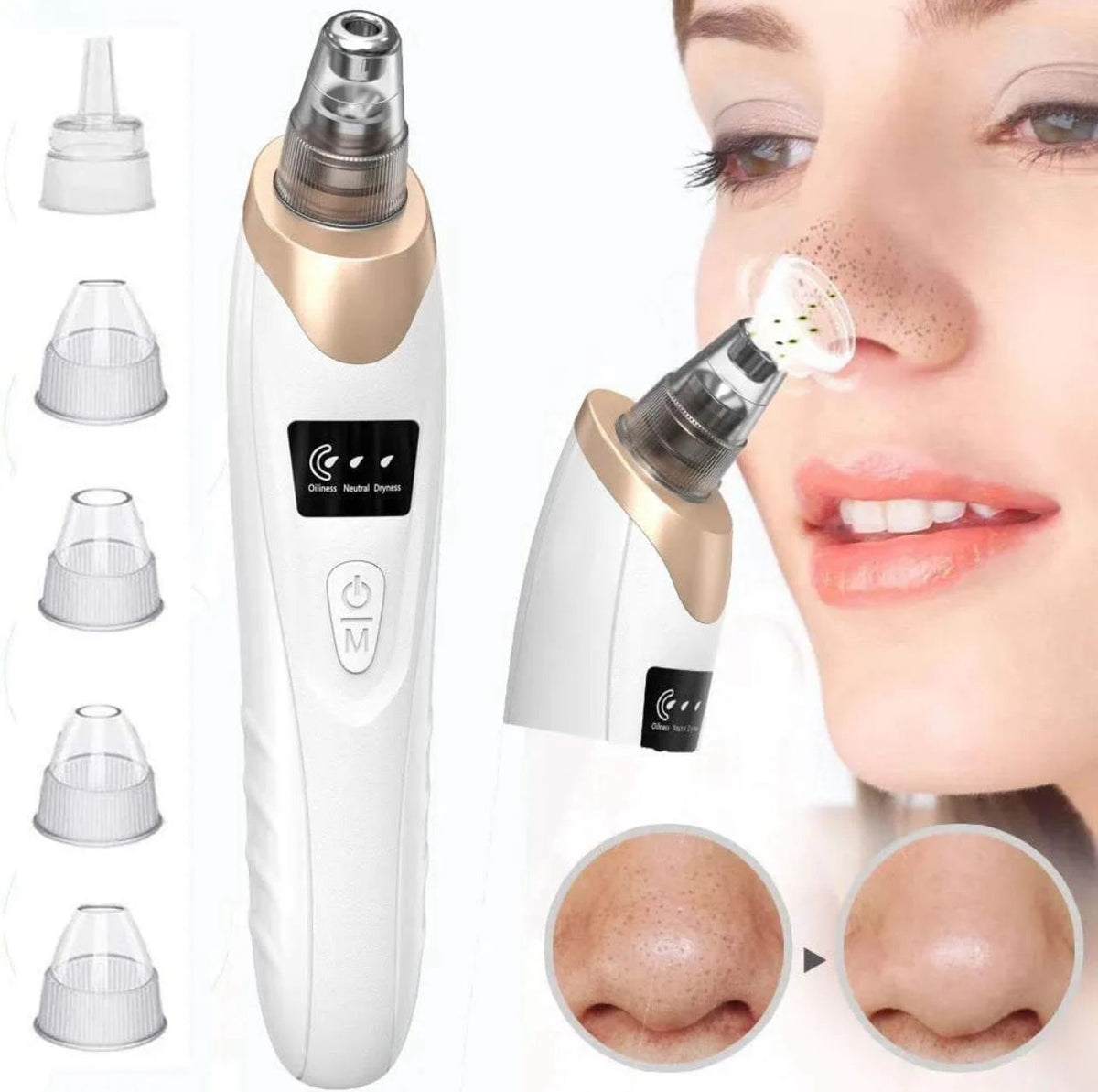 5 in 1 Blackhead Remover Vacuum – Electric Pore Cleaner with 5 Suction Heads, USB Rechargeable Facial Skin Care Tool