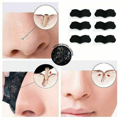 5pcs Nose Blackhead Remover Strips | Deep Pore Cleansing Mask