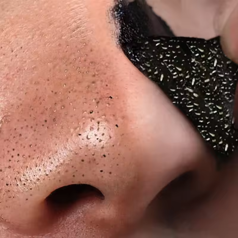 5pcs Nose Blackhead Remover Strips | Deep Pore Cleansing Mask