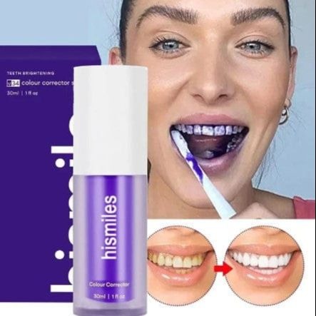 V34 Purple Teeth Whitening Serum 30ml – Colour Corrector Toothpaste for Yellow Teeth, Stain Neutralizer, Fresh Breath, Brighter Smile (Daant Safaid)